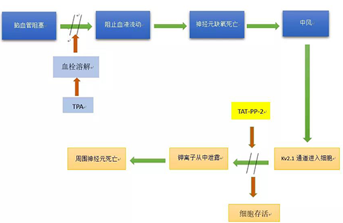 脑卒中形成机造