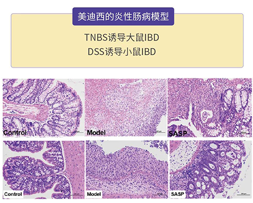 JDB电子的炎症性肠病模型
