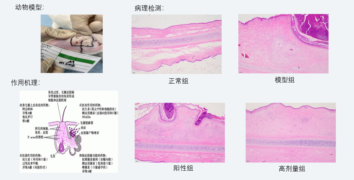 案例3：新西兰兔痤疮药效钻研.jpg